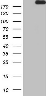 APOBR / APOB48R Antibody - HEK293T cells were transfected with the pCMV6-ENTRY control. (Left lane) or pCMV6-ENTRY APOBR. (Right lane) cDNA for 48 hrs and lysed. Equivalent amounts of cell lysates. (5 ug per lane) were separated by SDS-PAGE and immunoblotted with anti-APOBR.