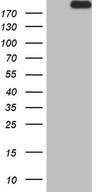 APOBR / APOB48R Antibody - HEK293T cells were transfected with the pCMV6-ENTRY control. (Left lane) or pCMV6-ENTRY APOBR. (Right lane) cDNA for 48 hrs and lysed. Equivalent amounts of cell lysates. (5 ug per lane) were separated by SDS-PAGE and immunoblotted with anti-APOBR.