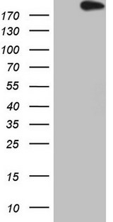 APOBR / APOB48R Antibody - HEK293T cells were transfected with the pCMV6-ENTRY control. (Left lane) or pCMV6-ENTRY APOBR. (Right lane) cDNA for 48 hrs and lysed. Equivalent amounts of cell lysates. (5 ug per lane) were separated by SDS-PAGE and immunoblotted with anti-APOBR. (1:2000)