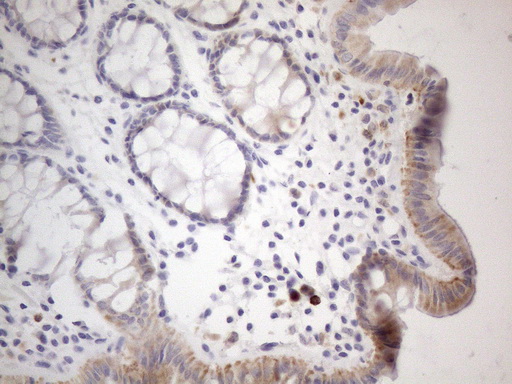 APOBR / APOB48R Antibody - Immunohistochemical staining of paraffin-embedded Human colon tissue within the normal limits using anti-APOBR mouse monoclonal antibody. (Heat-induced epitope retrieval by 1mM EDTA in 10mM Tris buffer. (pH8.5) at 120°C for 3 min. (1:150)
