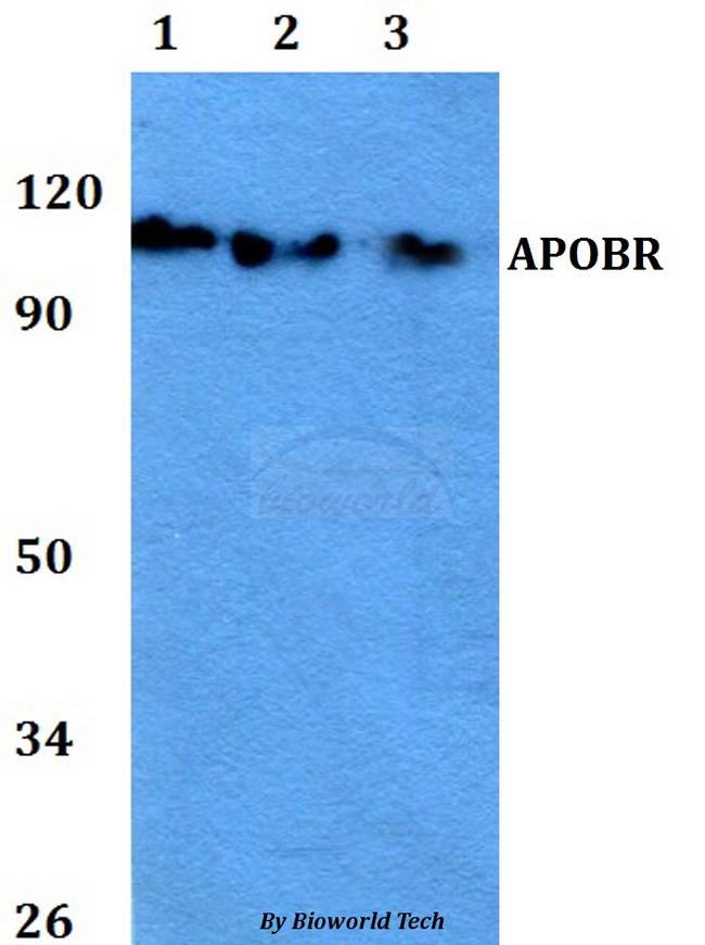 APOBR / APOB48R Antibody - Western blot of APOBR antibody at 1:500 dilution. Lane 1: A549 whole cell lysate. Lane 2: MCF-7 whole cell lysate. Lane 3: PC12 whole cell lysate.