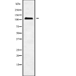 APOBR / APOB48R Antibody - Western blot analysis of APOB48R using HuvEc whole cells lysates
