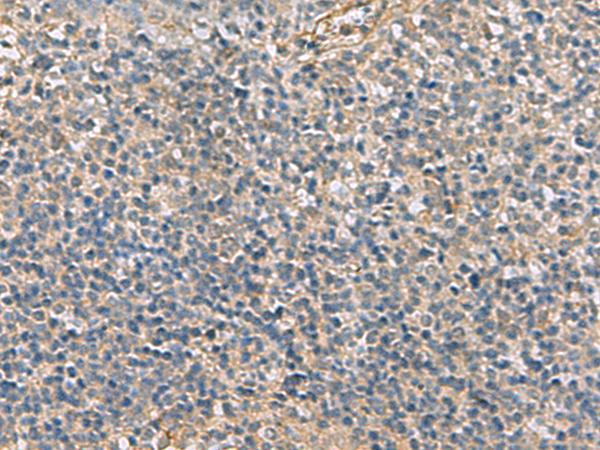 APOBR / APOB48R Antibody - Immunohistochemistry of paraffin-embedded Human tonsil tissue  using APOBR Polyclonal Antibody at dilution of 1:35(×200)
