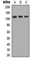 APOBR / APOB48R Antibody - Western blot analysis of Apolipoprotein B Receptor expression in A549 (A); MCF7 (B); PC12 (C) whole cell lysates.