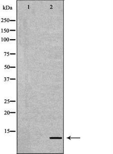 APOC2 / Apolipoprotein C II Antibody - Western blot analysis of mouse liver tissue lysates using APOC2 antibody. The lane on the left is treated with the antigen-specific peptide.