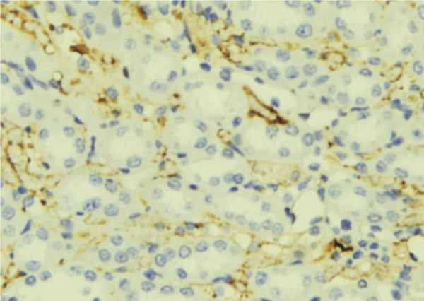 APOC2 / Apolipoprotein C II Antibody - 1:100 staining mouse liver tissue by IHC-P. The sample was formaldehyde fixed and a heat mediated antigen retrieval step in citrate buffer was performed. The sample was then blocked and incubated with the antibody for 1.5 hours at 22°C. An HRP conjugated goat anti-rabbit antibody was used as the secondary.
