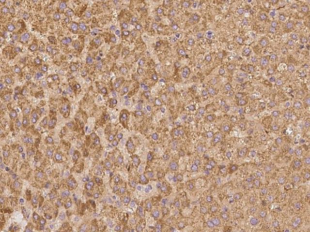 APOC2 / Apolipoprotein C II Antibody - Immunochemical staining of human APOC2 in human liver with rabbit polyclonal antibody at 1:100 dilution, formalin-fixed paraffin embedded sections.