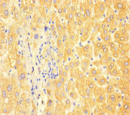 APOC3 / Apolipoprotein C III Antibody - Immunohistochemistry of paraffin-embedded human liver tissue at dilution of 1:100