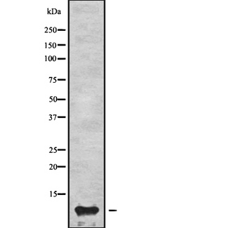 APOC3 / Apolipoprotein C III Antibody - Western blot analysis of APOC3 using K562 whole cells lysates