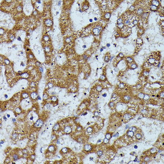 APOC3 / Apolipoprotein C III Antibody - Immunohistochemistry of paraffin-embedded Human liver using APOC3 Polyclonal Antibody at dilution of 1:100 (40x lens).