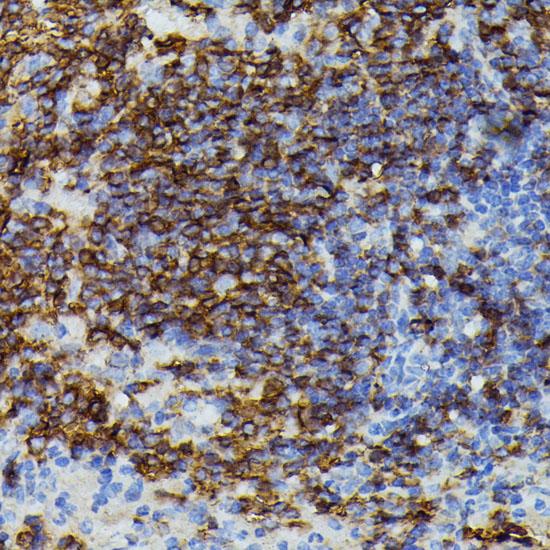 APOC3 / Apolipoprotein C III Antibody - Immunohistochemistry of paraffin-embedded Mouse spleen using APOC3 Polyclonal Antibody at dilution of 1:100 (40x lens).