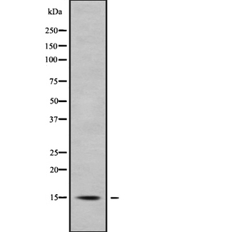 APOC4 / Apolipoprotein CIV Antibody - Western blot analysis of APOC4 using A549 whole cells lysates