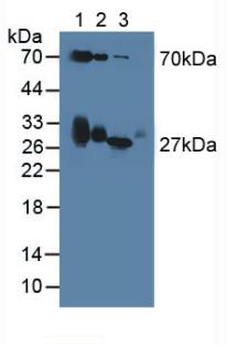 APOD / Apolipoprotein D Antibody - Western Blot; Sample: Lane1: Mouse Serum; Lane2: Mouse Blood Cells; Lane3: Mouse Spleen Tissue.