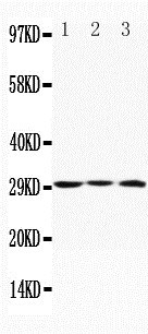 APOD / Apolipoprotein D Antibody - Anti-Apolipoprotein D antibody, Western blotting Lane 1: MCF-7 Cell LysateLane 2: HELA Cell LysateLane 3: SMMC Cell Lysate