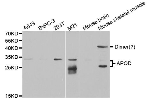 APOD / Apolipoprotein D Antibody - Western blot analysis of extracts of various cell lines.