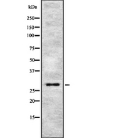 APOD / Apolipoprotein D Antibody - Western blot analysis of APOD using NIH-3T3 whole lysates.