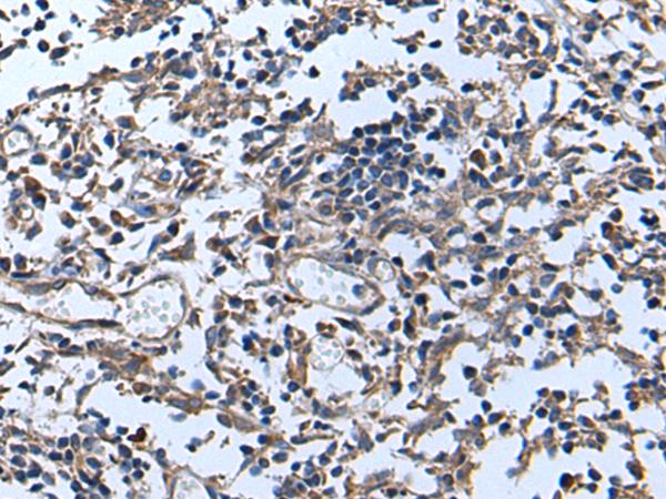 APOD / Apolipoprotein D Antibody - Immunohistochemistry of paraffin-embedded Human tonsil tissue  using APOD Polyclonal Antibody at dilution of 1:55(×200)
