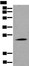 APOD / Apolipoprotein D Antibody - Western blot analysis of Human liver tissue lysate  using APOD Polyclonal Antibody at dilution of 1:550