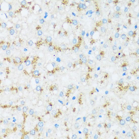 APOD / Apolipoprotein D Antibody - Immunohistochemistry of paraffin-embedded Human liver using APOD Polyclonal Antibody at dilution of 1:100 (40x lens).