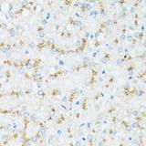 APOD / Apolipoprotein D Antibody - Immunohistochemistry of paraffin-embedded Human liver using APOD Polyclonal Antibody at dilution of 1:100 (40x lens).