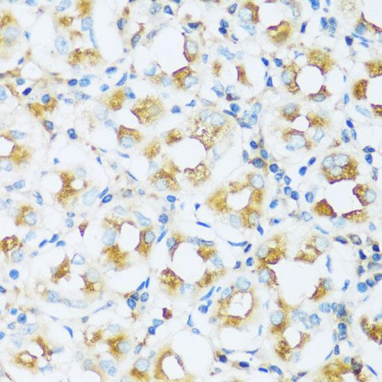 APOD / Apolipoprotein D Antibody - Immunohistochemistry of paraffin-embedded Human stomach using APOD Polyclonal Antibody at dilution of 1:100 (40x lens).