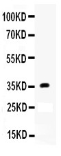 APOE / Apolipoprotein E Antibody - Apolipoprotein E antibody Western blot. All lanes: Anti Apolipoprotein E at 0.5 ug/ml. WB: Human Placenta Tissue Lysate at 50 ug. Predicted band size: 36 kD. Observed band size: 36 kD.