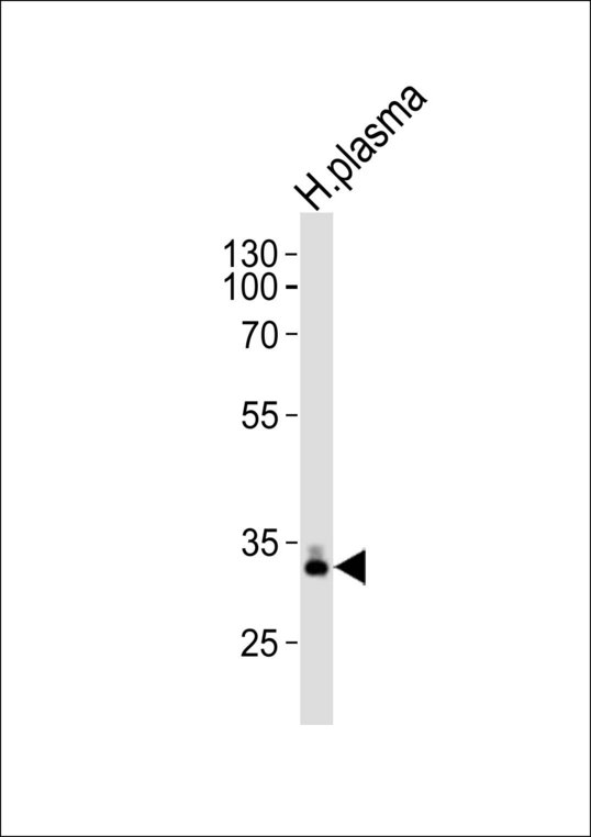 APOE / Apolipoprotein E Antibody - Western blot of lysate from human plasma tissue lysate, using APOE Antibody. Antibody was diluted at 1:1000. A goat anti-rabbit IgG H&L (HRP) at 1:10000 dilution was used as the secondary antibody. Lysate at 20ug.