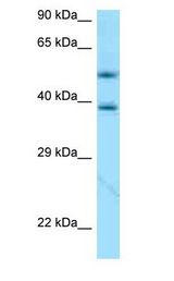APOE / Apolipoprotein E Antibody - APOE / Apolipoprotein E antibody Western Blot of 721_B.  This image was taken for the unconjugated form of this product. Other forms have not been tested.