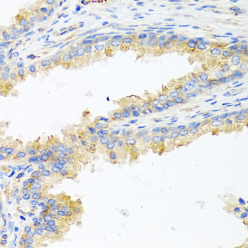 APOE / Apolipoprotein E Antibody - Immunohistochemistry of formalin-fixed paraffin-embedded (FFPE) human prostate using ApoE antibody at dilution of 1:100 (40x magnification).