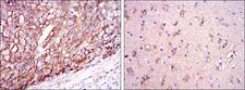 APOE / Apolipoprotein E Antibody - IHC of paraffin-embedded liver cancer tissues (left) and brain tissues (right) using ApoE mouse monoclonal antibody with DAB staining.