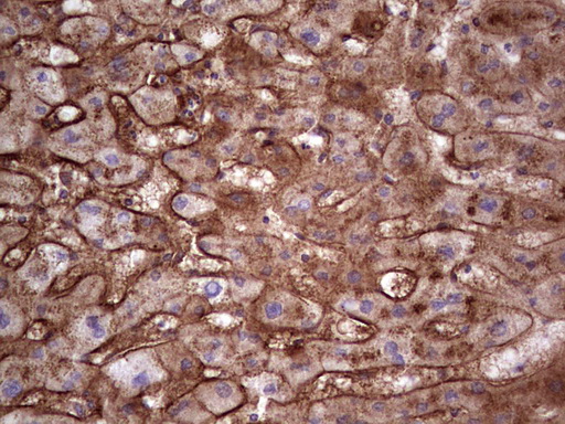 APOE / Apolipoprotein E Antibody - Immunohistochemical staining of paraffin-embedded Human liver tissue within the normal limits using anti-APOE mouse monoclonal antibody. (Heat-induced epitope retrieval by 1 mM EDTA in 10mM Tris, pH8.5, 120C for 3min,