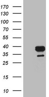 APOE / Apolipoprotein E Antibody - HEK293T cells were transfected with the pCMV6-ENTRY control. (Left lane) or pCMV6-ENTRY APOE. (Right lane) cDNA for 48 hrs and lysed. Equivalent amounts of cell lysates. (5 ug per lane) were separated by SDS-PAGE and immunoblotted with anti-APOE. (1:500)
