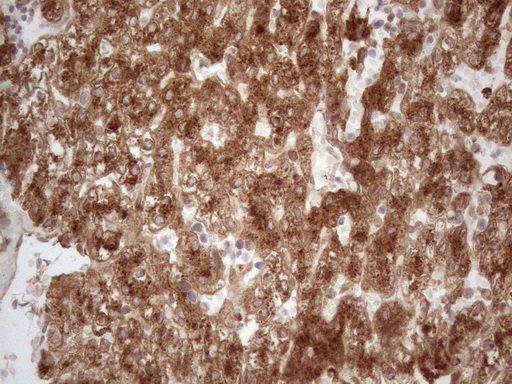 APOE / Apolipoprotein E Antibody - Immunohistochemical staining of paraffin-embedded Human embryonic liver tissue using anti-APOE mouse monoclonal antibody. (Heat-induced epitope retrieval by 1mM EDTA in 10mM Tris buffer. (pH8.5) at 120 oC for 3 min. (1:150)