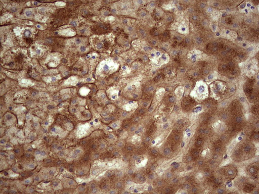 APOE / Apolipoprotein E Antibody - Immunohistochemical staining of paraffin-embedded Human liver tissue within the normal limits using anti-APOE mouse monoclonal antibody. (Heat-induced epitope retrieval by 1 mM EDTA in 10mM Tris, pH8.5, 120C for 3min,