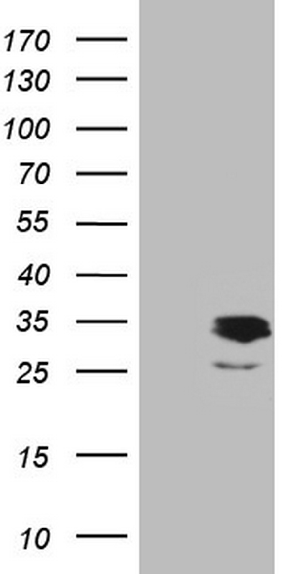 APOE / Apolipoprotein E Antibody - HEK293T cells were transfected with the pCMV6-ENTRY control (Left lane) or pCMV6-ENTRY APOE (Right lane) cDNA for 48 hrs and lysed. Equivalent amounts of cell lysates (5 ug per lane) were separated by SDS-PAGE and immunoblotted with anti-APOE.