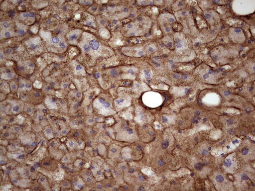 APOE / Apolipoprotein E Antibody - IHC of paraffin-embedded Human liver tissue using anti-APOE mouse monoclonal antibody. (Heat-induced epitope retrieval by 1 mM EDTA in 10mM Tris, pH8.5, 120°C for 3min).
