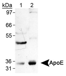 APOE / Apolipoprotein E Antibody - Detection of ApeE with APOE / Apolipoprotein E Antibody. Lane 1, human liver lysates. Lane 2, human brain lysates. This image was taken for the unconjugated form of this product. Other forms have not been tested.