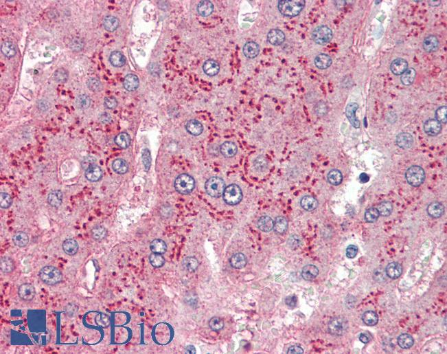 APOE / Apolipoprotein E Antibody - Liver:, Human Formalin-Fixed, Paraffin-Embedded (FFPE).  This image was taken for the unconjugated form of this product. Other forms have not been tested.