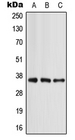 APOE / Apolipoprotein E Antibody - Western blot analysis of Apolipoprotein E expression in MCF7 (A); mouse liver (B); rat liver (C) whole cell lysates.