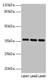 APOE / Apolipoprotein E Antibody - Western blot All lanes: Apolipoprotein E antibody at 2µg/ml Lane 1: Mouse lung tissue Lane 2: Mouse brain tissue Lane 3: Mouse liver tissue Secondary Goat polyclonal to rabbit IgG at 1/10000 dilution Predicted band size: 36 kDa Observed band size: 36 kDa
