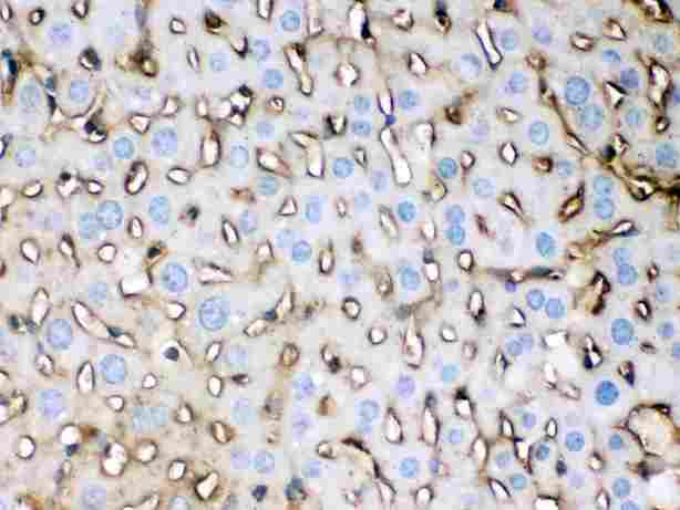 APOE / Apolipoprotein E Antibody - Apolipoprotein E was detected in paraffin-embedded sections of mouse liver tissues using rabbit anti- Apolipoprotein E Antigen Affinity purified polyclonal antibody