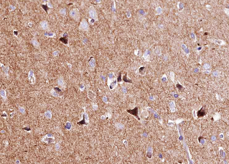 APOE / Apolipoprotein E Antibody - 1:100 staining human brain tissue by IHC-P. The tissue was formaldehyde fixed and a heat mediated antigen retrieval step in citrate buffer was performed. The tissue was then blocked and incubated with the antibody for 1.5 hours at 22°C. An HRP conjugated goat anti-rabbit antibody was used as the secondary.