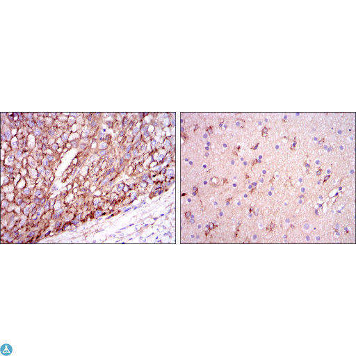 APOE / Apolipoprotein E Antibody - Immunohistochemistry (IHC) analysis of paraffin-embedded liver cancer tissues (left) and brain tissues (right) with DAB staining using ApoE Monoclonal Antibody.