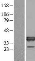 APOE / Apolipoprotein E Protein - Western validation with an anti-DDK antibody * L: Control HEK293 lysate R: Over-expression lysate