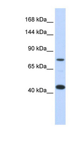 APOER2 / LRP8 Antibody - LRP8 / APOER2 antibody Western blot of Transfected 293T cell lysate. This image was taken for the unconjugated form of this product. Other forms have not been tested.