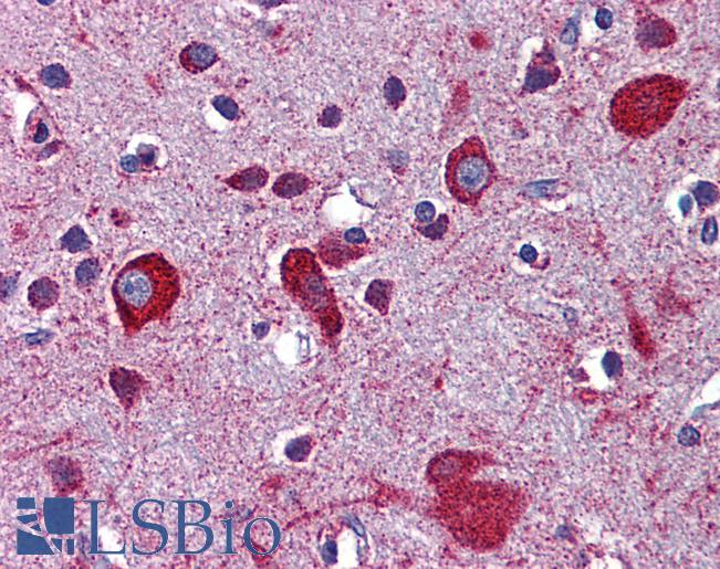 APOER2 / LRP8 Antibody - Anti-LRP8 antibody IHC of human brain, cortex. Immunohistochemistry of formalin-fixed, paraffin-embedded tissue after heat-induced antigen retrieval. Antibody concentration 5 ug/ml.  This image was taken for the unconjugated form of this product. Other forms have not been tested.