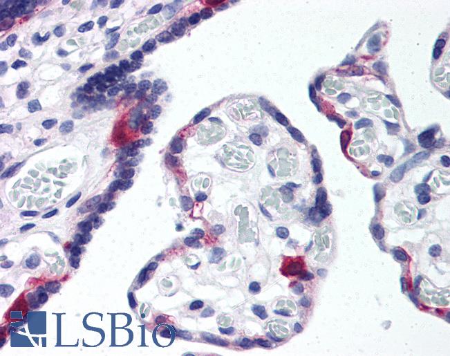 APOER2 / LRP8 Antibody - Anti-LRP8 antibody IHC of human placenta. Immunohistochemistry of formalin-fixed, paraffin-embedded tissue after heat-induced antigen retrieval. Antibody concentration 10 ug/ml.  This image was taken for the unconjugated form of this product. Other forms have not been tested.