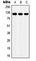 APOER2 / LRP8 Antibody - Western blot analysis of Apolipoprotein E Receptor 2 expression in MCF7 (A); NIH3T3 (B); H9C2 (C) whole cell lysates.