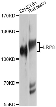 APOER2 / LRP8 Antibody - Western blot analysis of extracts of various cell lines, using LRP8 antibody at 1:1000 dilution. The secondary antibody used was an HRP Goat Anti-Rabbit IgG (H+L) at 1:10000 dilution. Lysates were loaded 25ug per lane and 3% nonfat dry milk in TBST was used for blocking. An ECL Kit was used for detection and the exposure time was 30s.