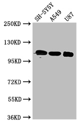 APOER2 / LRP8 Antibody - Positive WB detected in:SH-SY5Y whole cell lysate,A549 whole cell lysate,U87 whole cell lysate;All lanes:LRP8 antibody at 3ug/ml;Secondary;Goat polyclonal to rabbit IgG at 1/50000 dilution;Predicted band size: 106,78,100,88 kDa;Observed band size: 106 kDa;